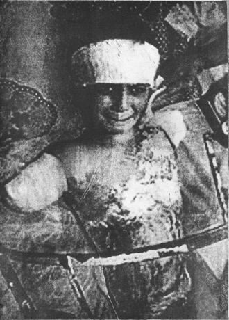 iraqicboywithoutarm