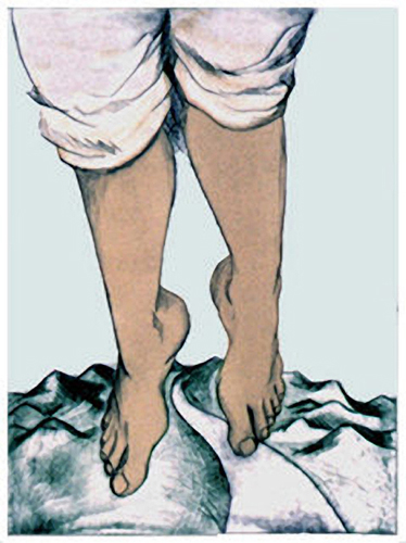 02_etching_feet
